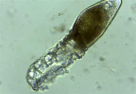  Un Sporozoario Unico: Quando un Parassita Microscopicico Incontra la Sfida di una Vita Mobile!