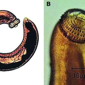 Gigantostoma spinigerum: Un parassita intestinale dai tratti di avventura globale!