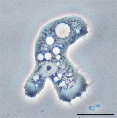  Acanthamoeba: Uno splendido predatore microscopico che danza tra le acque stagnanti e i peli del tuo animale domestico!